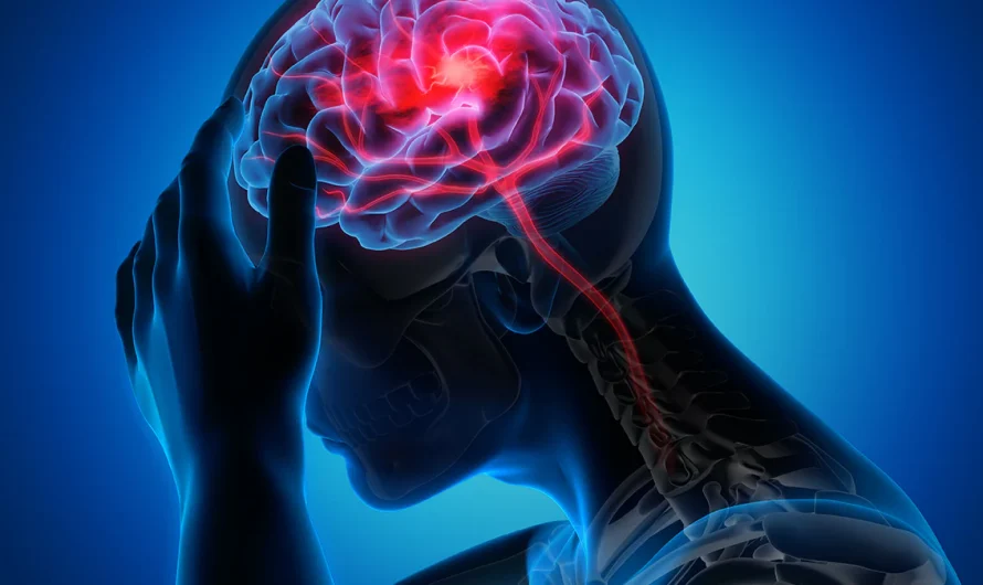 A Month Before a Stroke: Know the Warning Signs