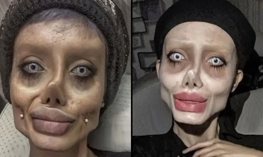 ‘Zombie’ Angelina Jolie Lookalike Shows Off Real Face After Release From Prison