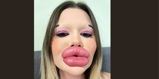 The individual boasting the largest lips on the planet!